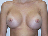 Patient # 59825 After Photo # 2